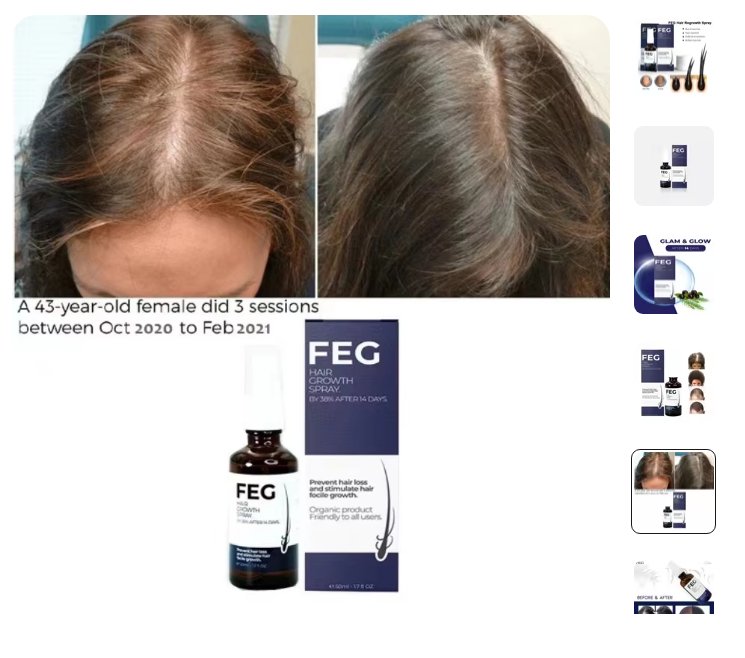 Pack of 2 FEG Hair Growth Spray Plus Derma Roller, Suitable For Both Men and Women